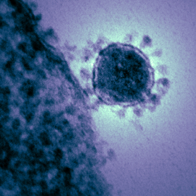 Mers coronavirus. National Institute of Allergy and Infectious Diseases (NIAID), National Institutes of Health (NIH) / Public domain
